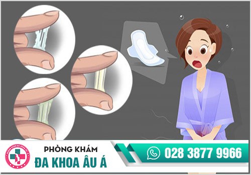 Bắt bệnh phụ khoa qua màu sắc bất thường của khí hư